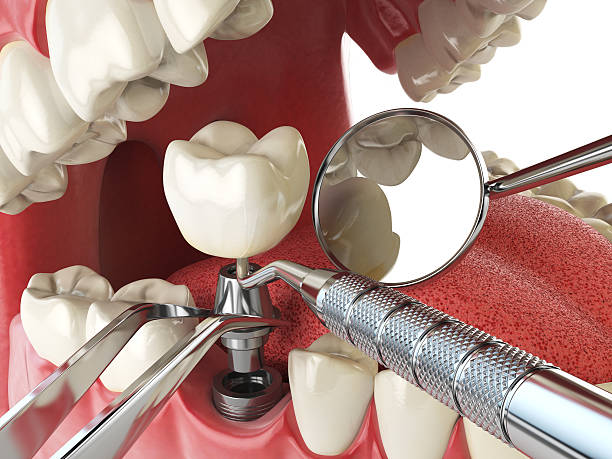Best Weekend Emergency Dentist in Meadow Les, AK